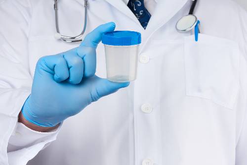 Evaluación de problemas en orina