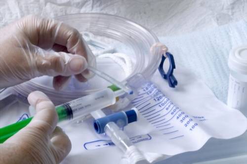 Retiro de catéter de hemodiálisis