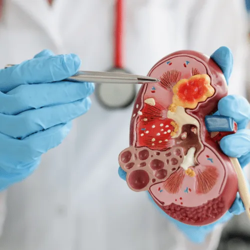 Abordaje Integral de la Acidosis Metabólica por un Nefrólogo Internista en CDMX